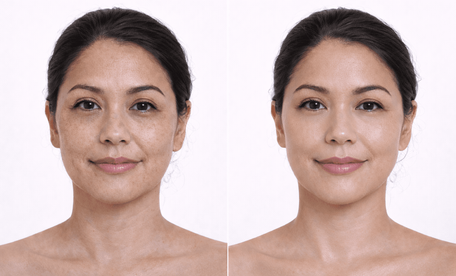 Before and after comparison of Vael GHK-Cu results